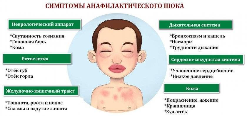 Симптомы и лечение аллергического бронхита у взрослых | медицинский центр «президент-мед»