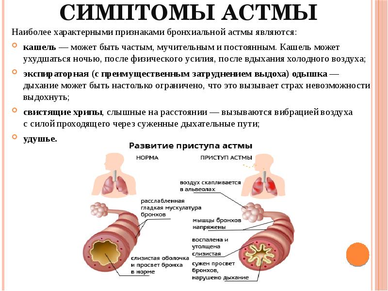 Основные симптомы при бронхиальной астме