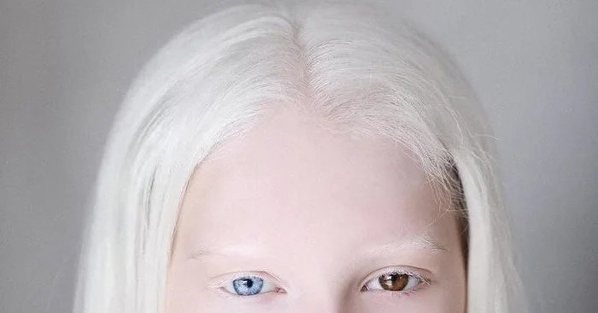 Животные-альбиносы. альбиносы. экологические факторы. альбиносы – редкая красота или уродство?