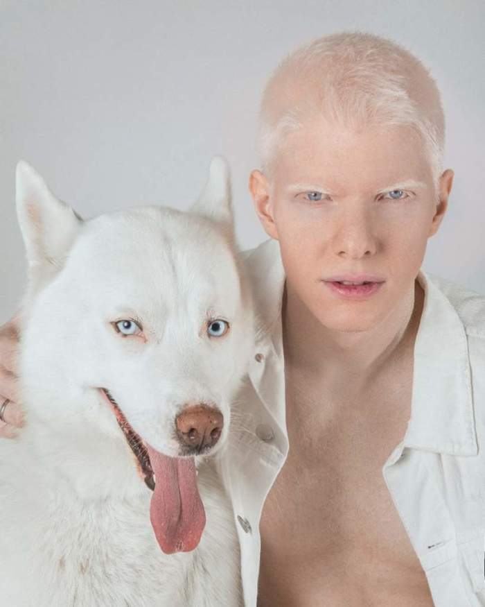Интересные факты об альбиносах - zefirka
