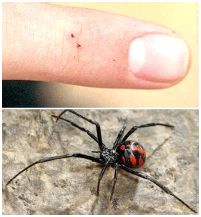 Что делать если укусил тарантул