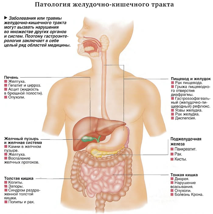 Заболевания желудочно кишечного тракта картинки