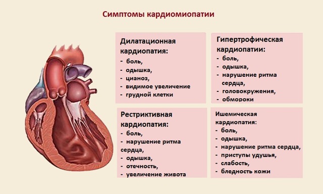 ГКМП у кошек (гипертрофическая кардиомиопатия)