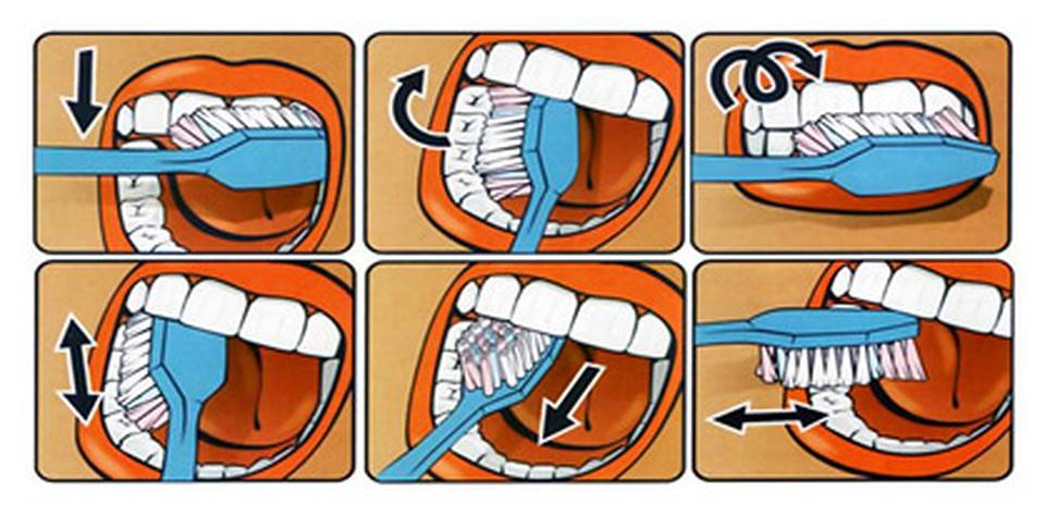 Как правильно чистить зубы: 15 советов и техника от врача