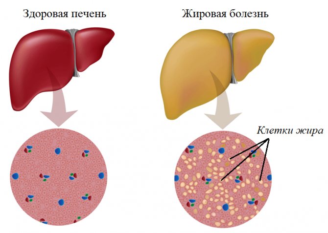 Болезни печени у котов