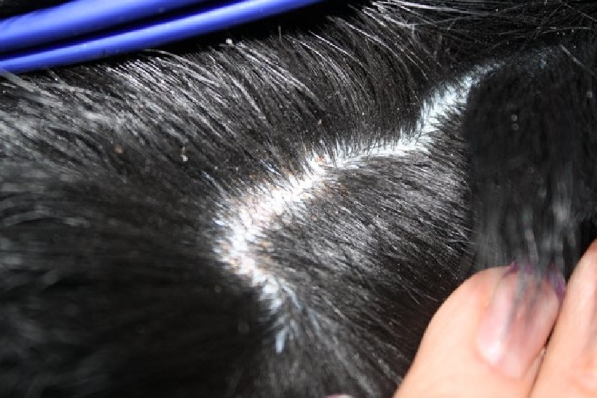 Перхоть у кошки на спине и хвосте, причины и методы лечения