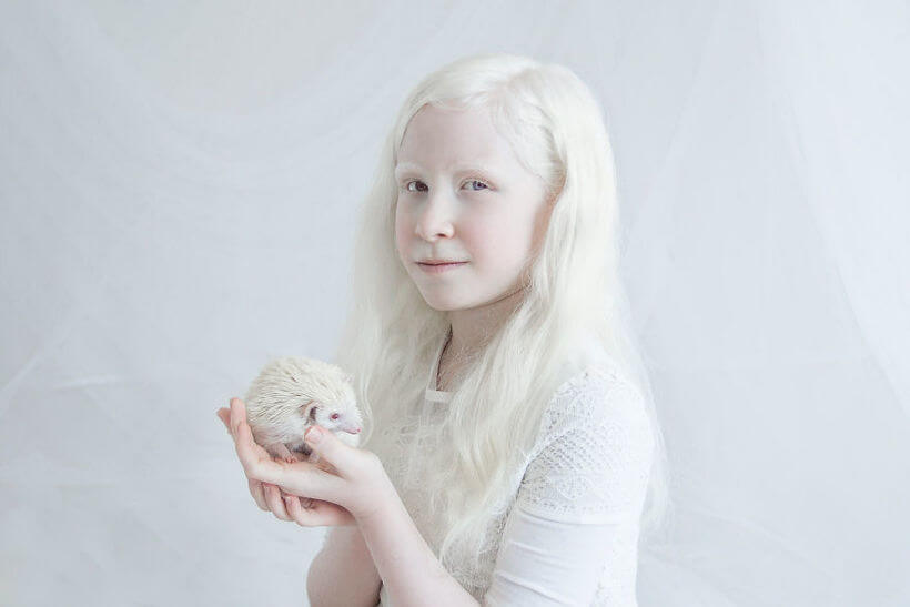 Кто такие альбиносы: признаки. сколько лет живут альбиносы люди, почему они долго не живут?